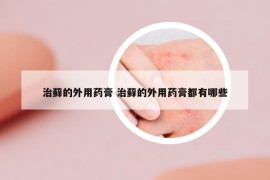治蘚的外用藥膏 治蘚的外用藥膏都有哪些