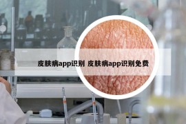 皮膚病app識別 皮膚病app識別免費