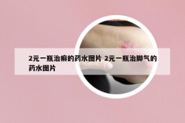 2元一瓶治癬的藥水圖片 2元一瓶治腳氣的藥水圖片