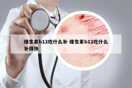 維生素b12吃什么補 維生素b12吃什么補得快