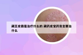 藏王皮霸是治療什么的 藏藥皮寶藥膏主要治什么