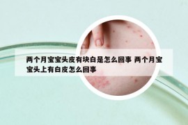 兩個(gè)月寶寶頭皮有塊白是怎么回事 兩個(gè)月寶寶頭上有白皮怎么回事