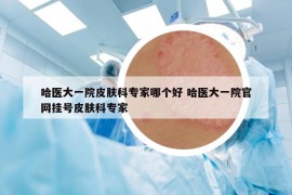 哈醫(yī)大一院皮膚科專家哪個好 哈醫(yī)大一院官網(wǎng)掛號皮膚科專家
