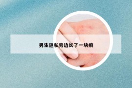 男生隱私旁邊長(zhǎng)了一塊癬