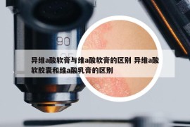 異維a酸軟膏與維a酸軟膏的區(qū)別 異維a酸軟膠囊和維a酸乳膏的區(qū)別