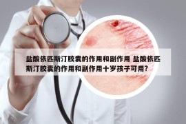 鹽酸依匹斯汀膠囊的作用和副作用 鹽酸依匹斯汀膠囊的作用和副作用十歲孩子可用?