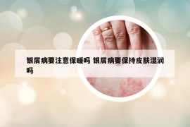 銀屑病要注意保暖嗎 銀屑病要保持皮膚濕潤(rùn)嗎