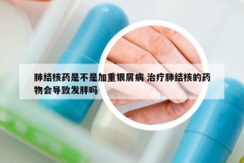 肺結(jié)核藥是不是加重銀屑病 治療肺結(jié)核的藥物會(huì)導(dǎo)致發(fā)胖嗎