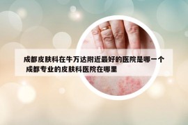 成都皮膚科在牛萬達(dá)附近最好的醫(yī)院是哪一個(gè) 成都專業(yè)的皮膚科醫(yī)院在哪里