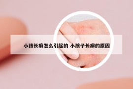 小孩長癬怎么引起的 小孩子長癬的原因
