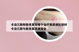 卡泊三醇和他克莫司哪個治療銀屑病比較好 卡泊三醇與他克莫司更安全