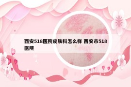 西安518醫(yī)院皮膚科怎么樣 西安市518醫(yī)院