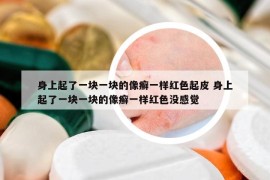 身上起了一塊一塊的像癬一樣紅色起皮 身上起了一塊一塊的像癬一樣紅色沒感覺