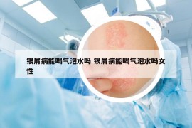 銀屑病能喝氣泡水嗎 銀屑病能喝氣泡水嗎女性