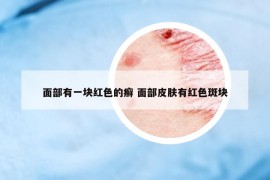 面部有一塊紅色的癬 面部皮膚有紅色斑塊