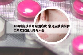 100種皮膚病對照圖癥狀 常見皮膚病的種類及癥狀圖片簡介大全