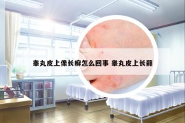 睪丸皮上像長癬怎么回事 睪丸皮上長蘚