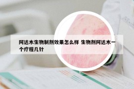 阿達(dá)木生物制劑效果怎么樣 生物劑阿達(dá)木一個療程幾針