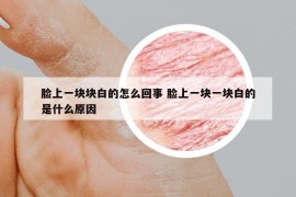 臉上一塊塊白的怎么回事 臉上一塊一塊白的是什么原因