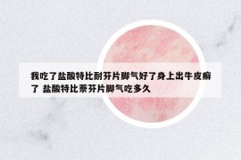 我吃了鹽酸特比耐芬片腳氣好了身上出牛皮癬了 鹽酸特比萘芬片腳氣吃多久