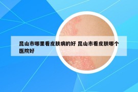 昆山市哪里看皮膚病的好 昆山市看皮膚哪個(gè)醫(yī)院好