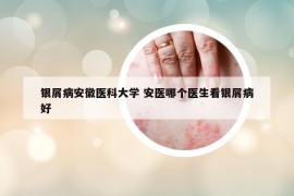銀屑病安徽醫(yī)科大學(xué) 安醫(yī)哪個(gè)醫(yī)生看銀屑病好