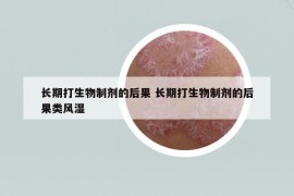 長期打生物制劑的后果 長期打生物制劑的后果類風(fēng)濕