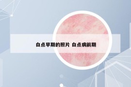 白點早期的照片 白點病前期
