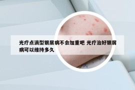 光療點(diǎn)滴型銀屑病不會(huì)加重吧 光療治好銀屑病可以維持多久