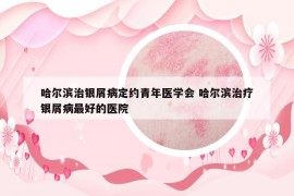 哈爾濱治銀屑病定約青年醫(yī)學(xué)會(huì) 哈爾濱治療銀屑病最好的醫(yī)院