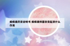 癬癢康藥膏說明書 癬癢康抑菌軟膏起到什么作用