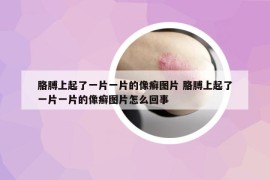 胳膊上起了一片一片的像癬圖片 胳膊上起了一片一片的像癬圖片怎么回事