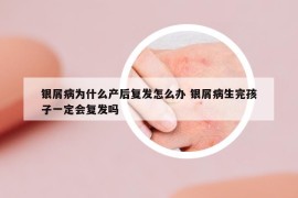 銀屑病為什么產(chǎn)后復發(fā)怎么辦 銀屑病生完孩子一定會復發(fā)嗎