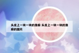頭皮上一塊一塊的像癬 頭皮上一塊一塊的像癬的圖片