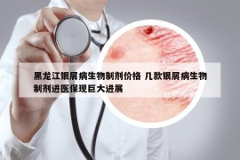 黑龍江銀屑病生物制劑價格 幾款銀屑病生物制劑進醫(yī)?，F(xiàn)巨大進展