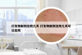 打生物制劑住院幾天 打生物制劑住院幾天可以出院