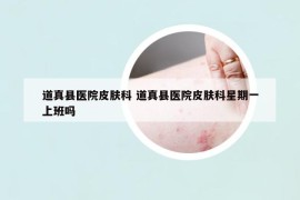 道真縣醫(yī)院皮膚科 道真縣醫(yī)院皮膚科星期一上班嗎