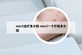 mect治療多少錢 mect一個(gè)療程多少錢