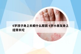 6歲孩子身上長癬什么原因 6歲小朋友身上經(jīng)常長坨