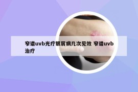 窄譜uvb光療銀屑病幾次見效 窄譜uvb治療