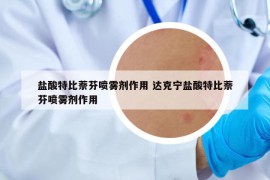 鹽酸特比萘芬噴霧劑作用 達(dá)克寧鹽酸特比萘芬噴霧劑作用