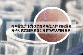 維阿露復(fù)方卡力孜然酊效果怎么樣 維阿露復(fù)方卡力孜然酊效果怎么樣有沒有人有好案例