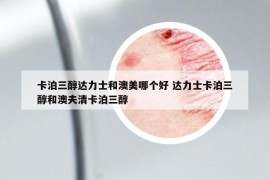 卡泊三醇達(dá)力士和澳美哪個好 達(dá)力士卡泊三醇和澳夫清卡泊三醇