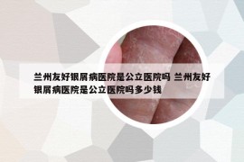 蘭州友好銀屑病醫(yī)院是公立醫(yī)院嗎 蘭州友好銀屑病醫(yī)院是公立醫(yī)院嗎多少錢