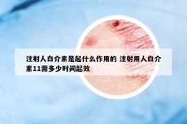 注射人白介素是起什么作用的 注射用人白介素11需多少時間起效