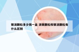 銀消顆粒多少錢一盒 消銀顆粒和銀消顆粒有什么區(qū)別