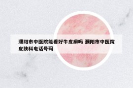 濮陽(yáng)市中醫(yī)院能看好牛皮癬嗎 濮陽(yáng)市中醫(yī)院皮膚科電話號(hào)碼