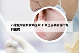 石家莊?？雌つw病醫(yī)院 石家莊皮膚病治療?？漆t(yī)院