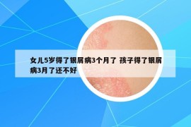 女兒5歲得了銀屑病3個月了 孩子得了銀屑病3月了還不好