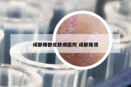 成都雍都皮膚病醫(yī)院 成都雍渡